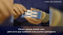 Fotofrase 3M Steri-Strip S