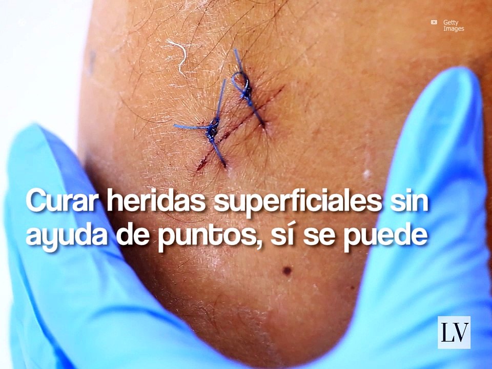 La técnica para cerrar heridas Steri Strips