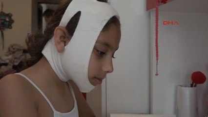 Antalya Dağ Kızağı Kazasında Çenesi 3 Yerden Kırıldı