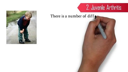 Check these Types Of Arthritis To Better Control on Your Health