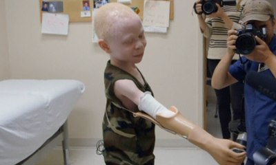 Bocah Albino Diburu Anggota Tubuhnya untuk Ritual Mistis