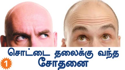 Mozambique Police Warn  Bald People After Ritual Fights | Oneindia Tamil