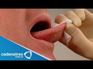 ¿Cómo detectar si hay cáncer bucal?
