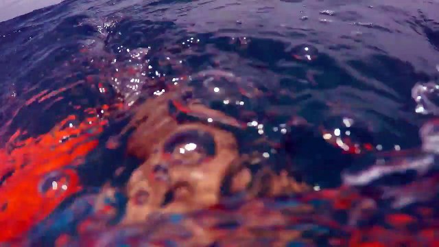 Il se fait attaquer par un requin et perd 1 litre de sang