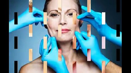 Căng da mặt nội soi trẻ hóa làn da xóa tan nếp nhăn