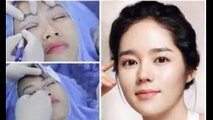 Nhấn mí Hàn Quốc mang lại đôi mắt đẹp trong sáng