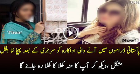 Actress is Tough To Recognize After Her Surgery, See How She is Looking