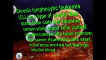 Chronic Lymphocytic Leukemia -- Signs and Symptoms of this Disease