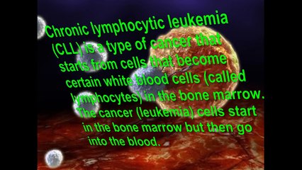 Chronic Lymphocytic Leukemia -- Signs and Symptoms of this Disease