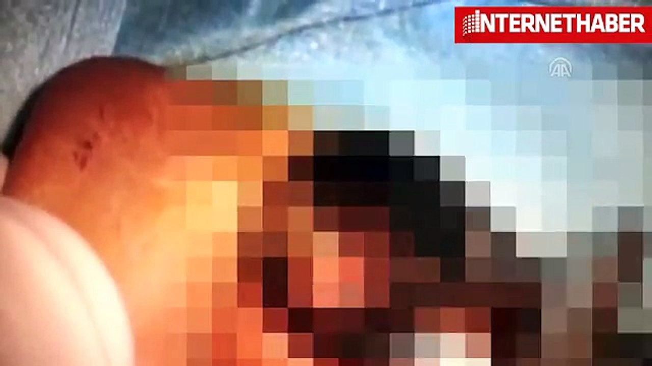 Çocuğun kulağından sinek larvaları çıktı videosu