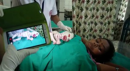 Amazing the shape new born baby latest 2017