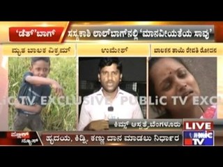 Bangalore: Boy Dies In An Accident In Lal Bagh, Parents Donate Dead Child's Organs