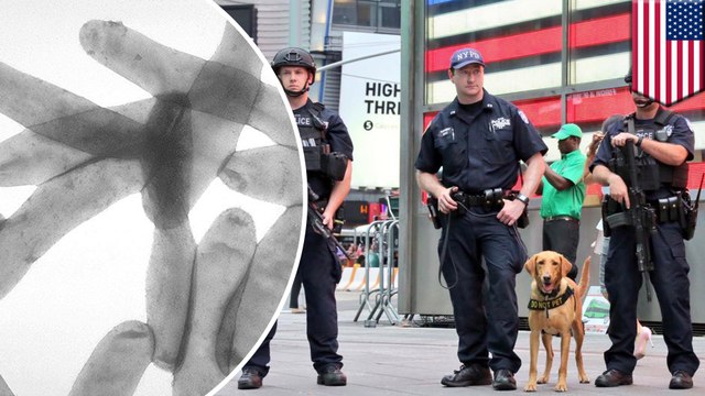 New York cops told not to shower after Legionnaires’ bacteria found