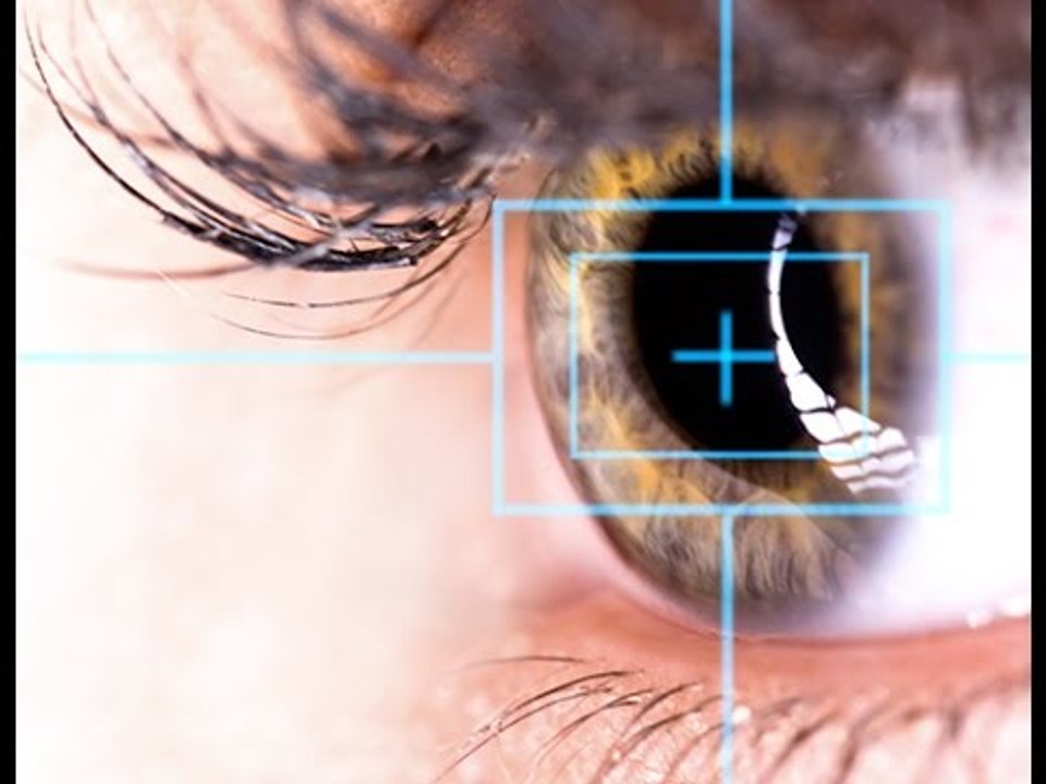 En quoi consiste une opération au laser en cas de myopie ?