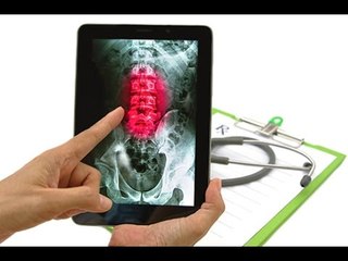 Qu’est-ce que l’arthrose lombaire ?