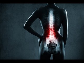 Becs de perroquet et arthrose : quelle(s) différence(s) y-a-t-il ?