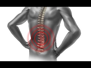 Qu’est-ce que le « bec de perroquet » ?