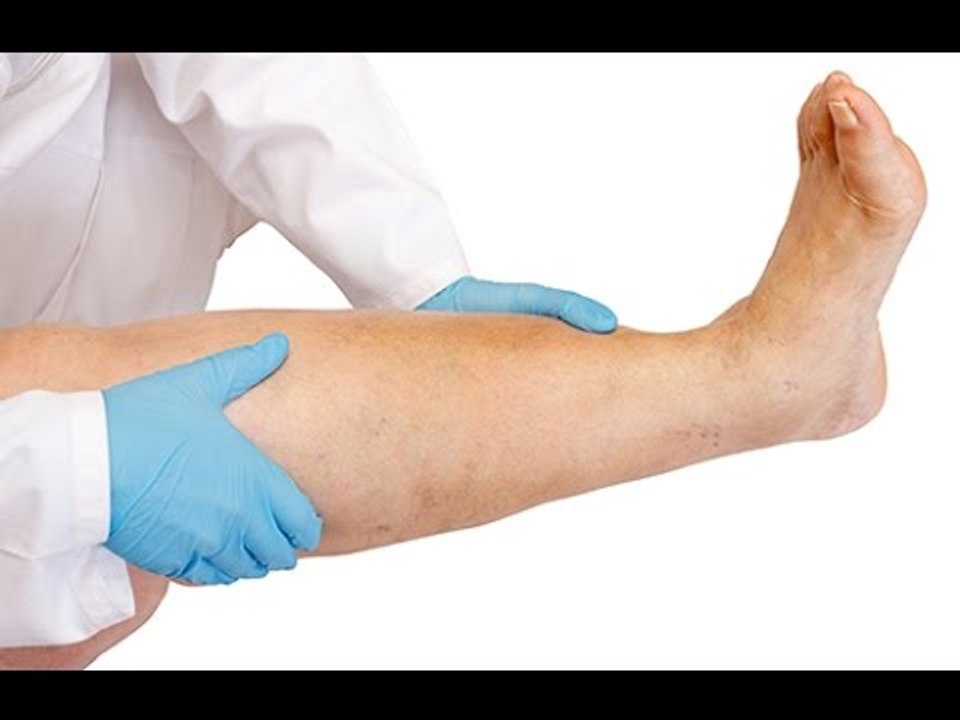 Phlébite des bras et phlébite des jambes: sont-elles pareilles?