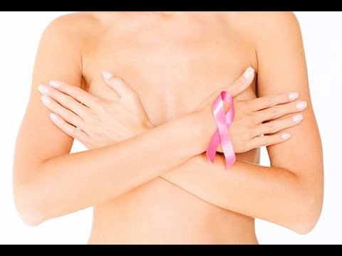 Guérison du cancer du sein: quelles sont les statistiques?