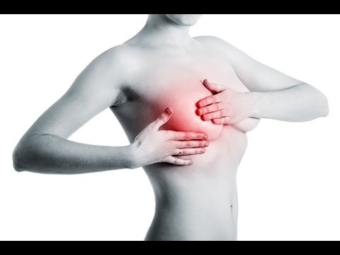 Cancer du sein: quelles sont les statistiques ?