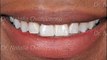 West Frisco Dental And Implants  - Dentist In Frisco TX - Frisco Dentist