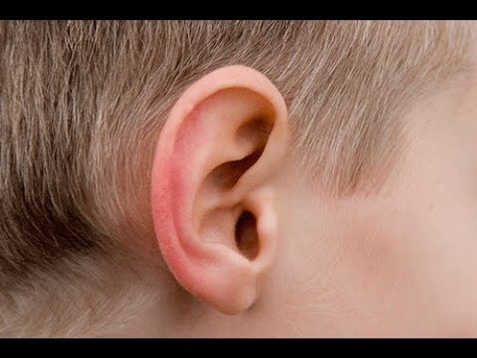 Qu'est-ce qu'une otite ?