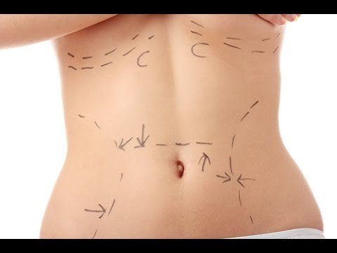 Quels sont les bienfaits du massage après une chirurgie esthétique ?