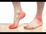 Prendre soin de ses pieds : prévenir l'apparition de durillons