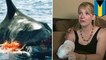 Shark attacks: North Carolina woman loses arm in horrific shark attack while snorkeling