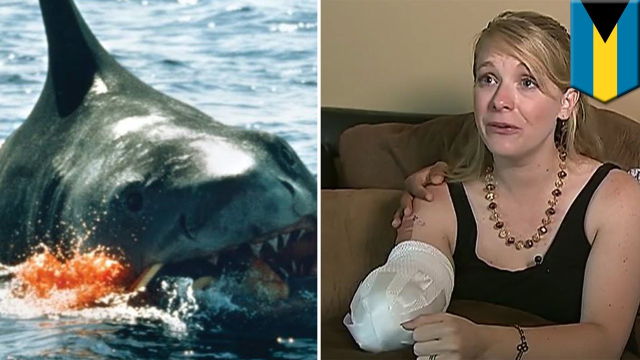 French woman loses both hands, breast in shark attack in Polynesia