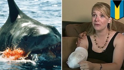 Shark attacks: North Carolina woman loses arm in horrific shark attack while snorkeling