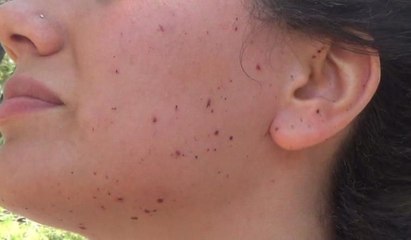 Havai fişekler mezuniyet gecesini kabusa çevirdi: 9 yaralı