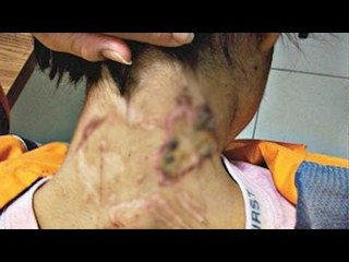 La terrible historia de la joven que vivió encadenada 2 años en Tlalpan