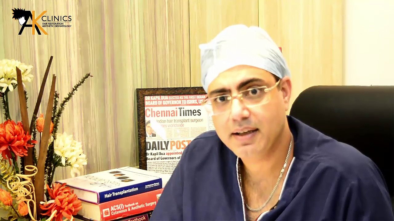 Does the transplanted hair fall after hair tranplant.