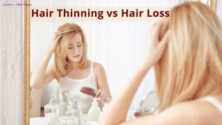 Hair Shedding-Life Cycle Of Hair-Hair Thinning Cycle in Men & Women Explained-Hair Expert Dino