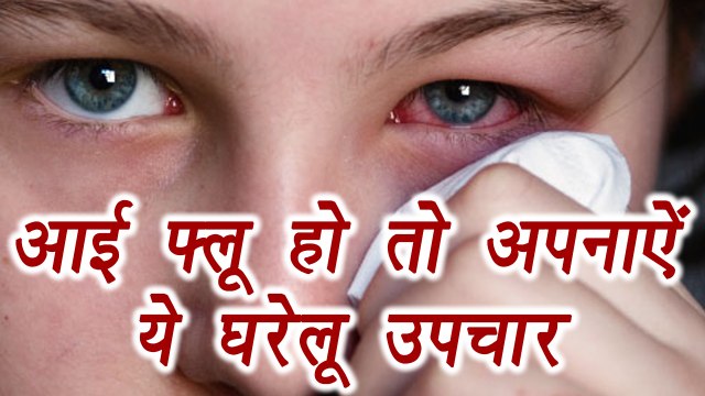 Conjunctivitis, Eye flu | Home Remedies | Boldsky