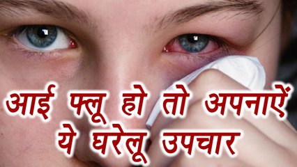 Conjunctivitis, Eye flu | Home Remedies | Boldsky