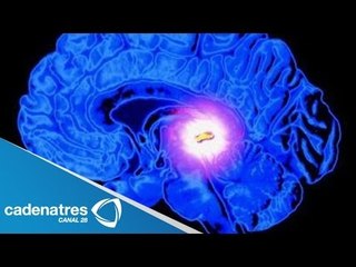 ¿Qué es la glándula pineal?