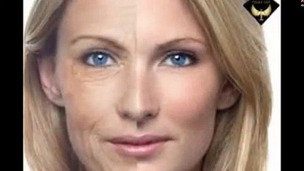 Căng da mặt nội soi xóa bỏ các nếp nhăn do thời gian để lại