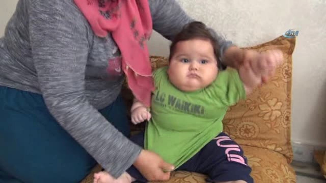 Minik Yakup Yardım Bekliyor&hellip; 3,5 Kilo Doğdu 8 Ayda 20 Kiloya Ulaştı