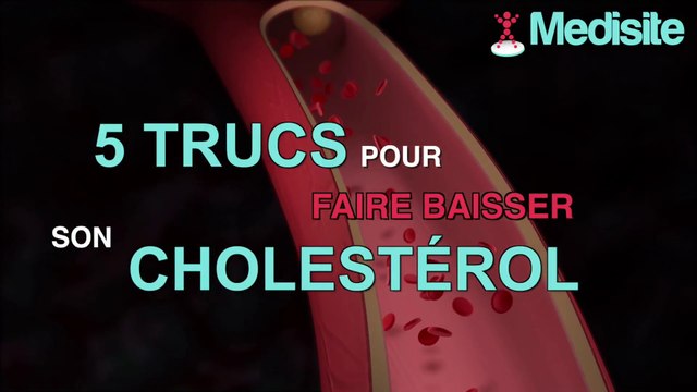 5 conseils pour faire baisser son cholestérol