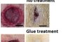 30.Wound-healing glue could prevent scars