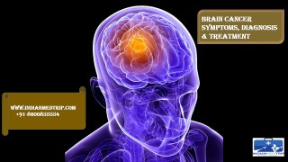 Brain Cancer-Symptoms,Diagnosis & Treatment