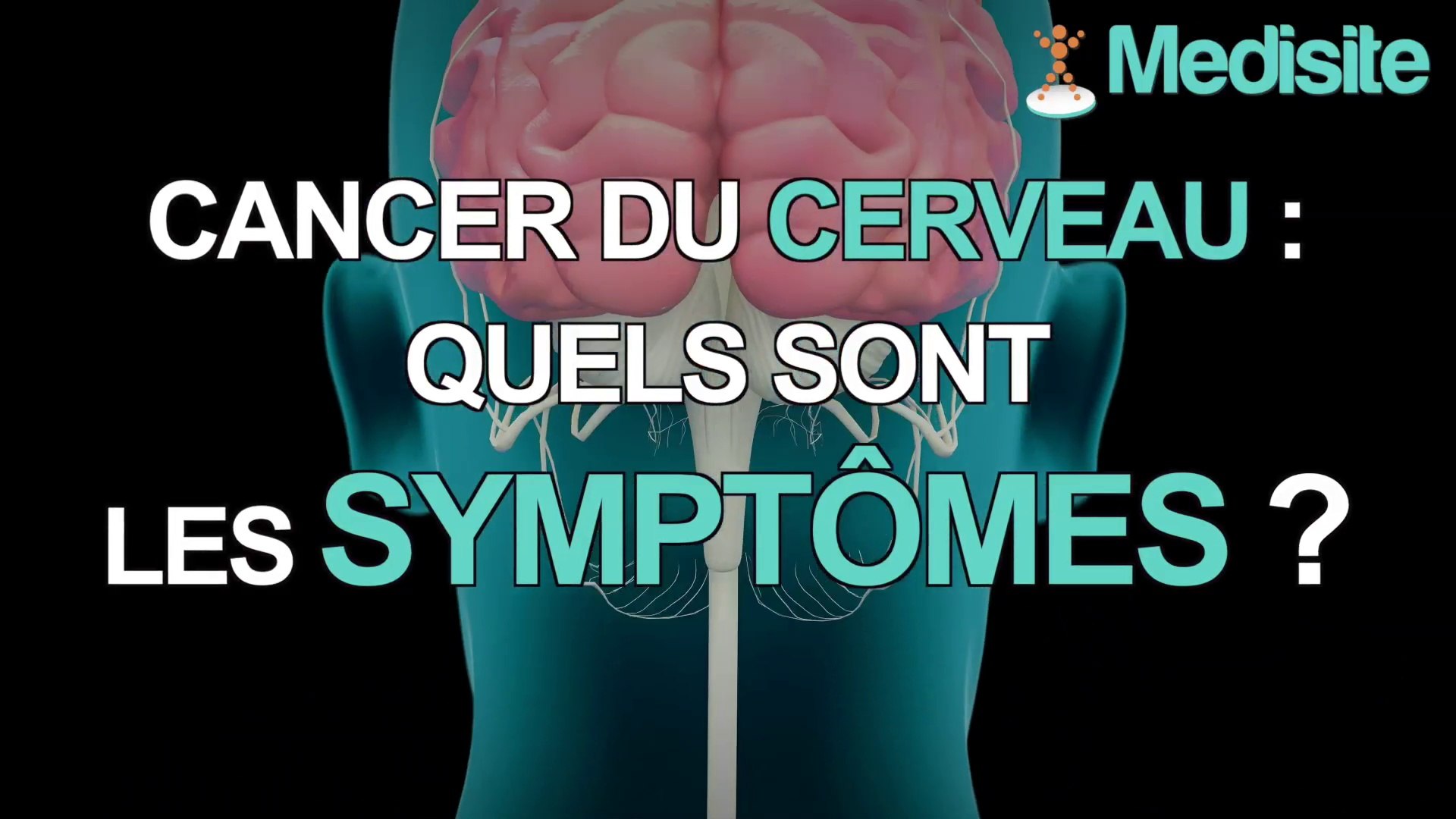 Cancer du cerveau : quels sont les symptômes ?