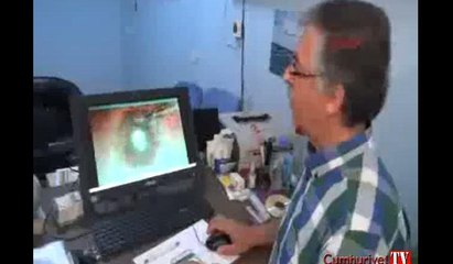 Mikroskop kamerası göz ameliyatında depremi kaydetti