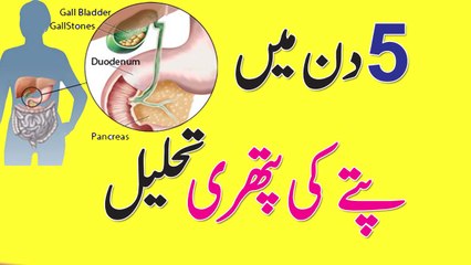Gall Bladder Stone Treatment At Home || Pitay Ki Pathri Ka Ilaaj