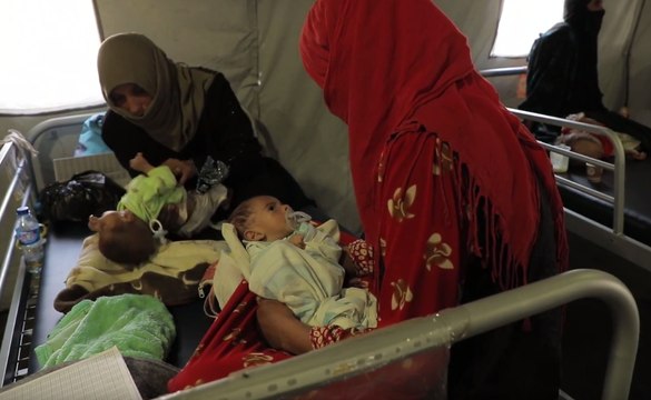 Malnourished Mosul Babies Treated at MSF Medical Center in Qayyarah