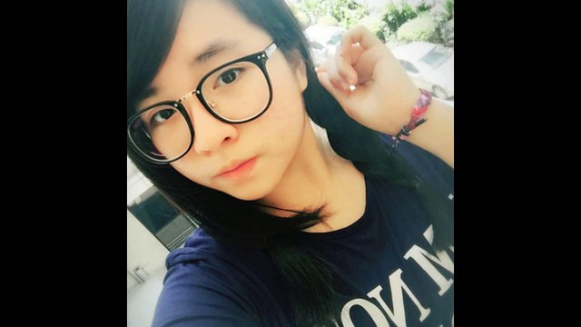 căng da mặt không cần phẫu thuật trinhmy - TS.BS. Mai Mạnh Tuấn