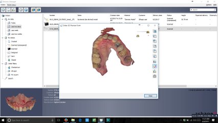 how you can convert dcm files into stl part 1