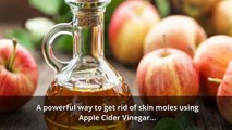 This Apple Cider Vinegar (ACV) Skin Mole Removal Treatment